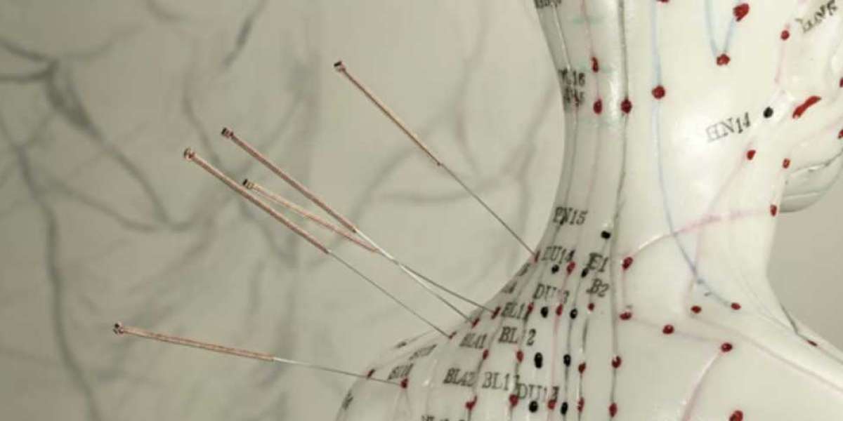 Navigating the World of Acupuncture: Understanding Different Styles and Finding the Right Practitioner for You