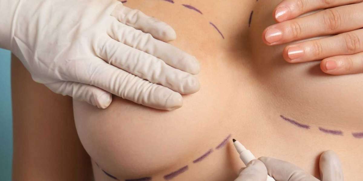 Choosing Between Autologous Fat Transfer and Synthetic Fillers