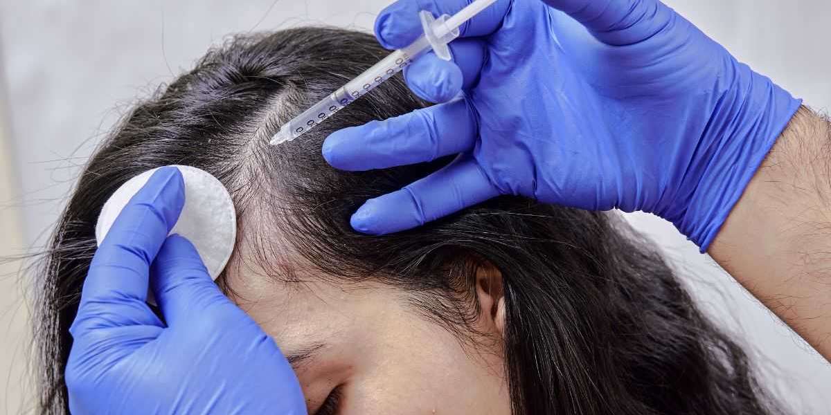 Unlocking Opportunities: Mexico Anti-Hair Loss Treatments Market
