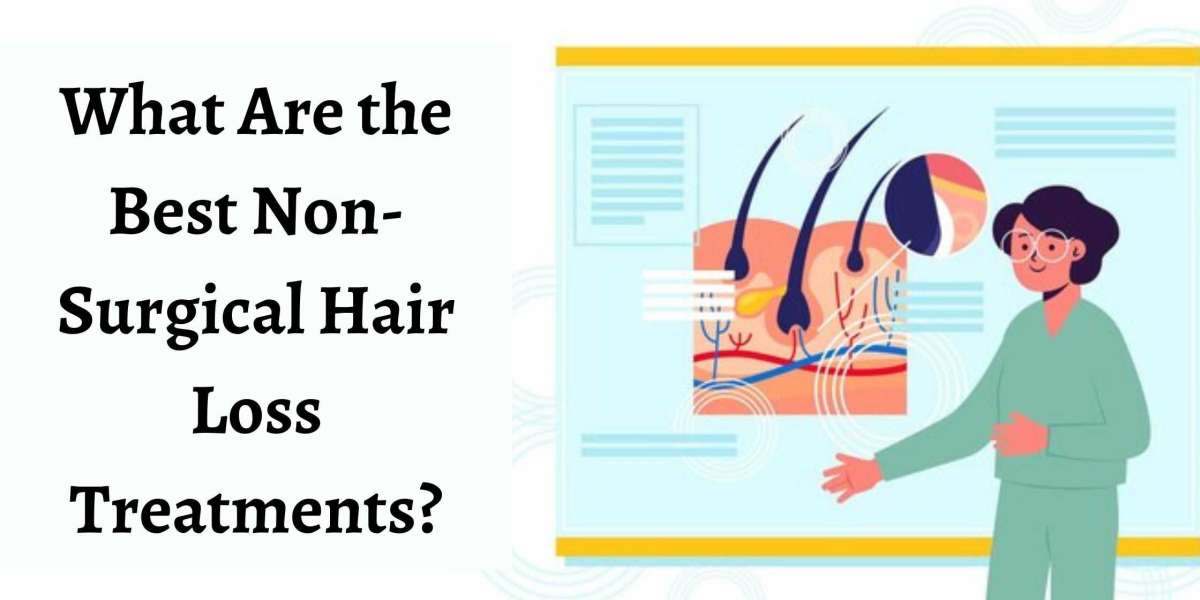 What Are the Best Non-Surgical Hair Loss Treatments?