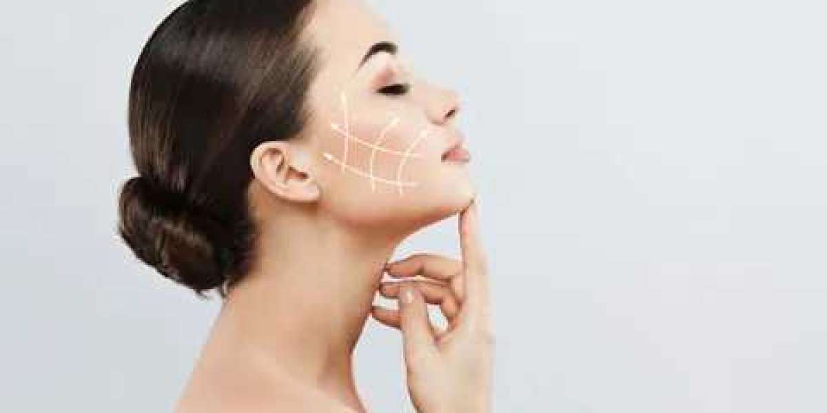 Facelift Treatment in Islamabad: Surgery vs. Non-Surgery Options