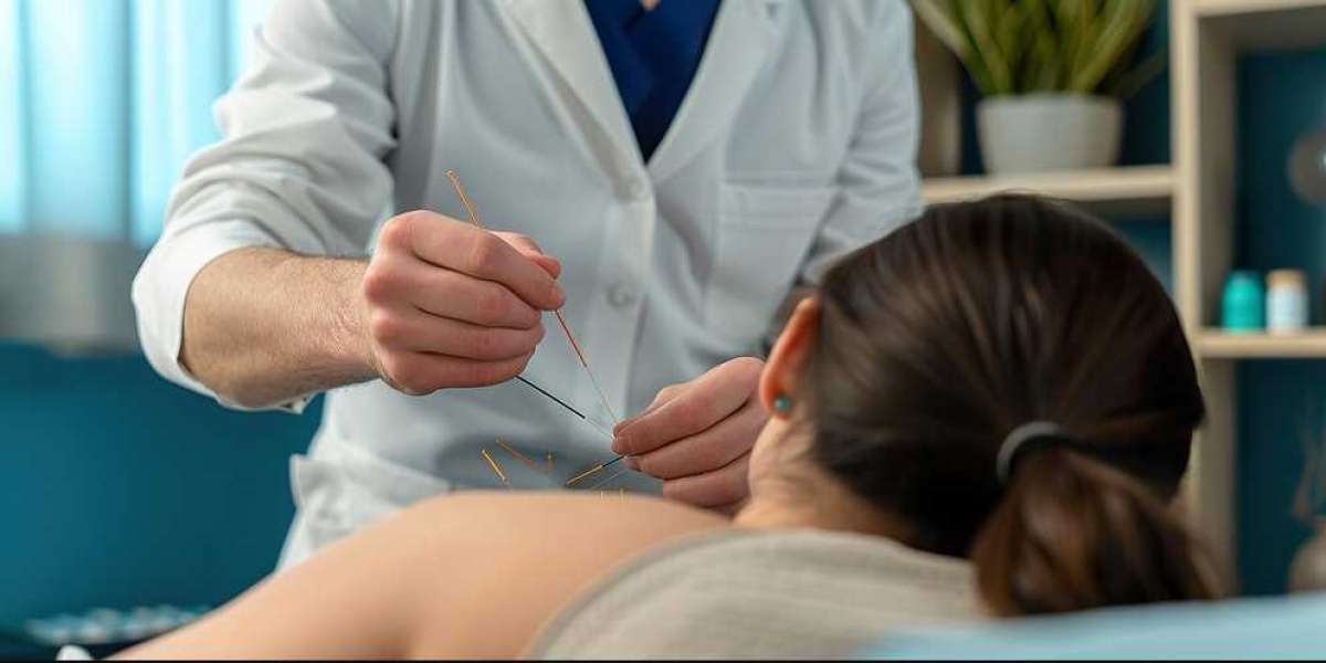 The Secret Benefits of Regular Visits to Your Acupuncture Clinic