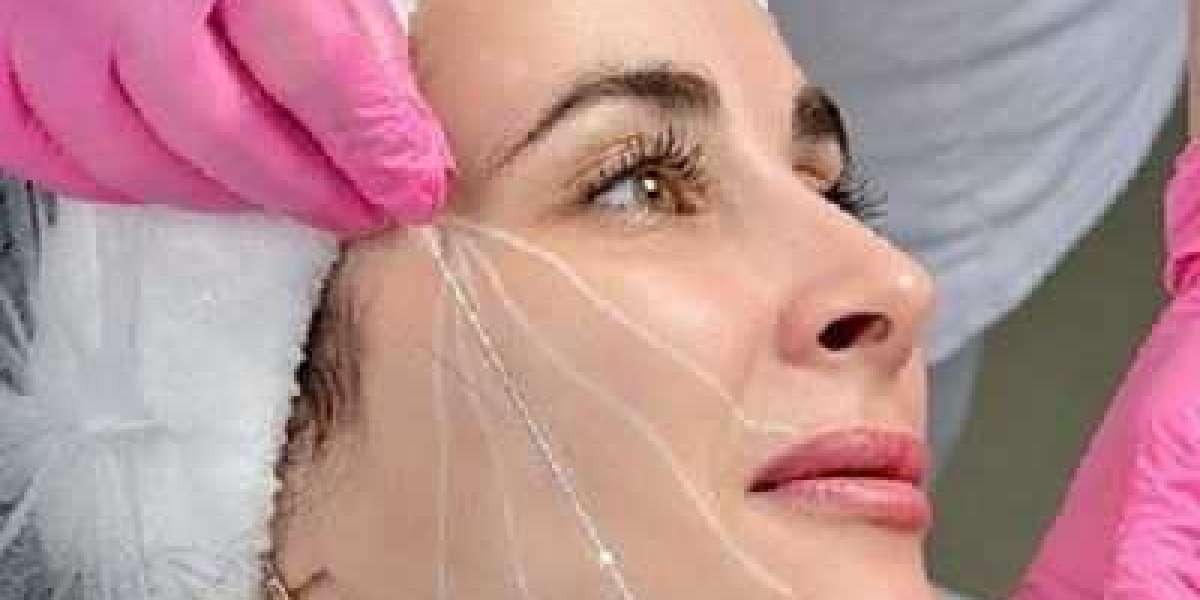 Top Benefits of Thread Lifts in Islamabad