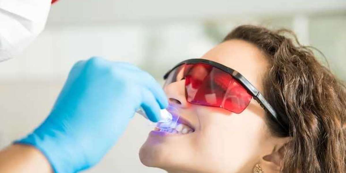 Explore Teeth Whitening Singapore Prices for Stunning Results