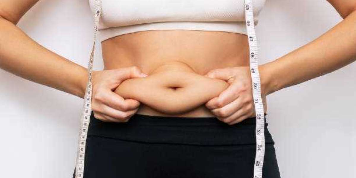 Exploring Liposuction in Islamabad: Transforming Body Contours