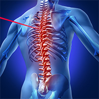 Pain-Free Living with Riva Clinic's Spine Laser treatment