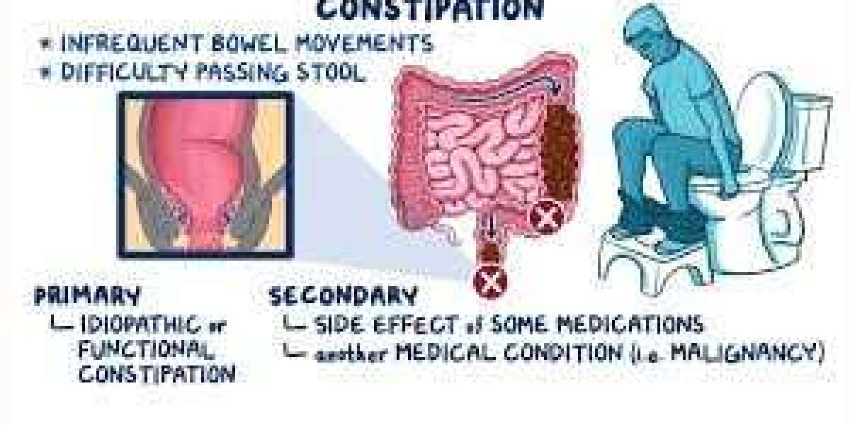 What Are the Differences Between Acute and Chronic Constipation?