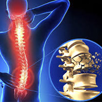 Trusted Spine Injury Doctors at Riva Clinic - Book Now