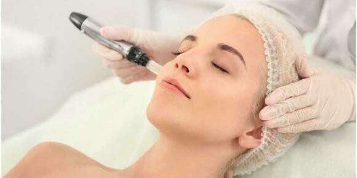 Microneedling vs. Laser Treatments: Which Is Better for Your Skin in Islamabad?