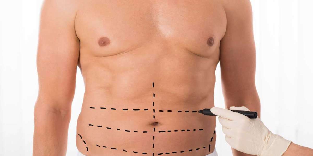 The Science Behind Liposuction Surgery