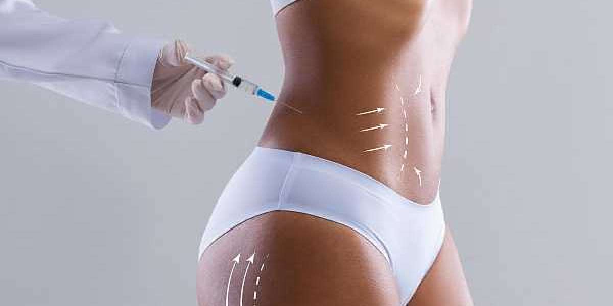 Top Clinics Offering Fat Dissolving Injection