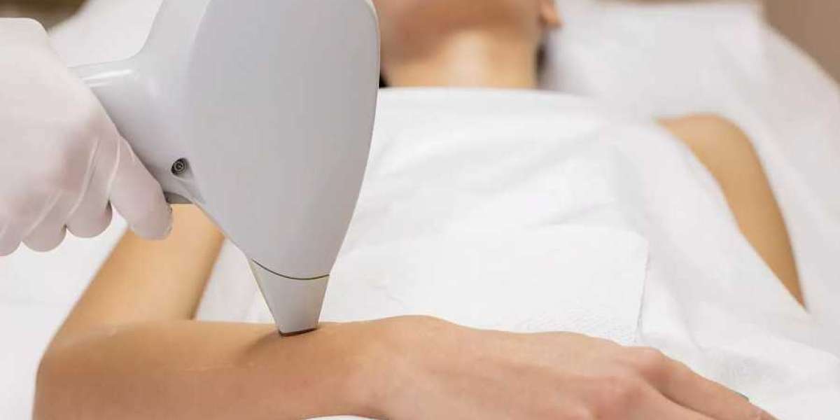 Laser Hair Removal: Is It Safe for Dark Skin